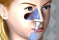 The saline solution fills the nasal cavity.